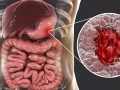 Ulcer Home Remedy: ये 4 चीजें करेंगी पेट के छाले का अंत, साइंस ने माना- दवा से कम नहीं ये नुस्खे